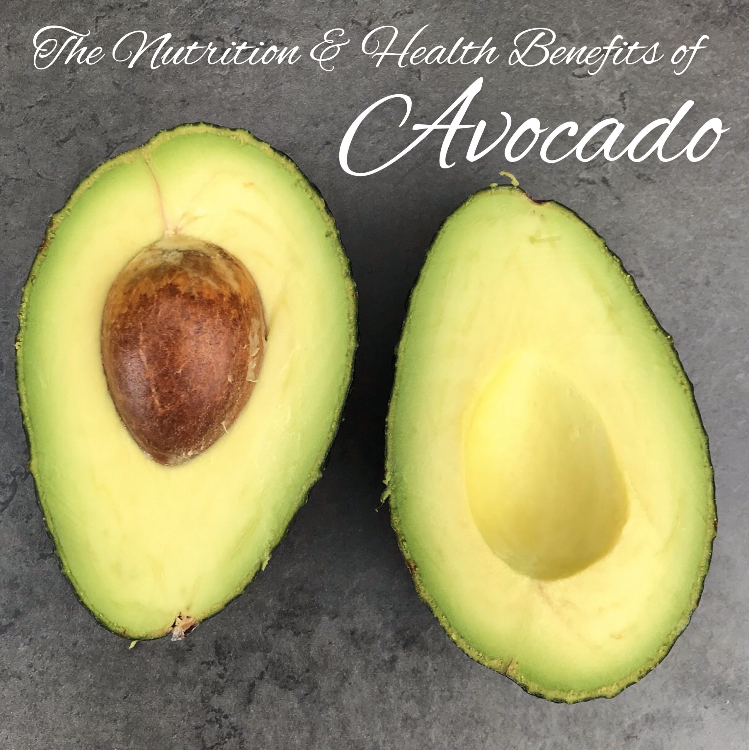 6 Health Benefits of Avocados